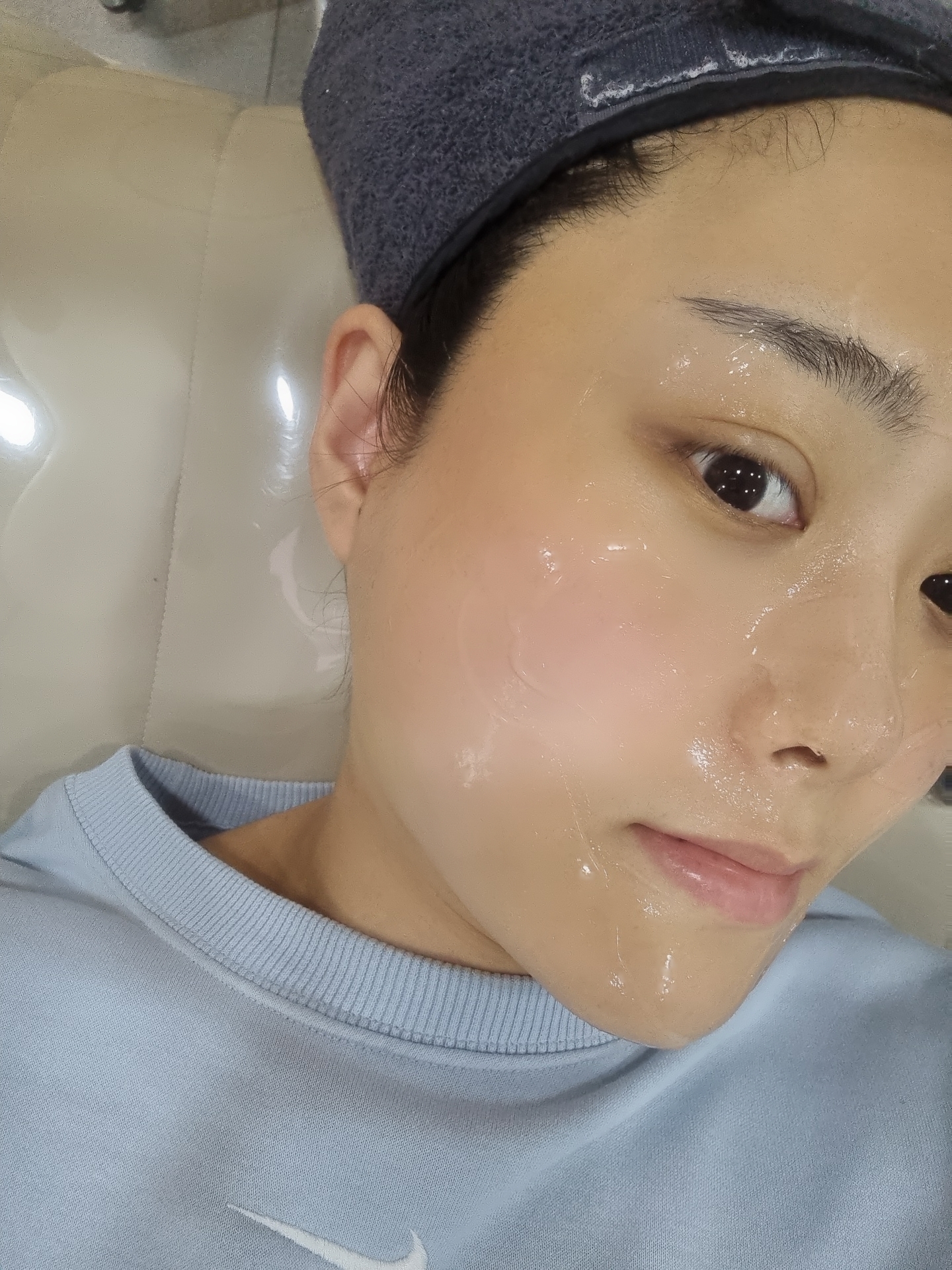 레이저 리프팅 솔직후기