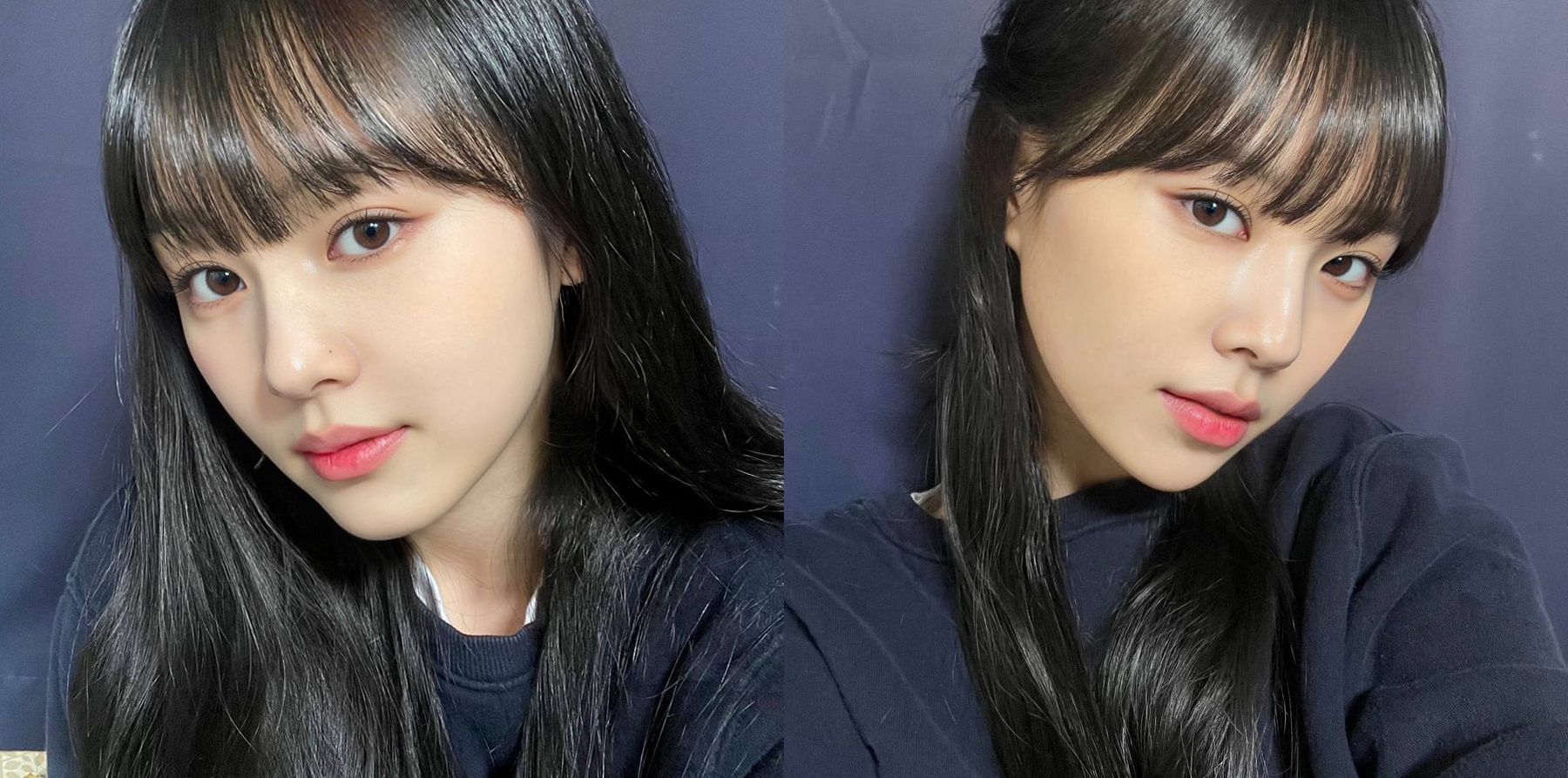 이노톡스 스킨보톡스+턱보톡스+옆볼,팔자필러 후기♥️