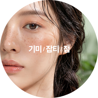 기미, 잡티, 점